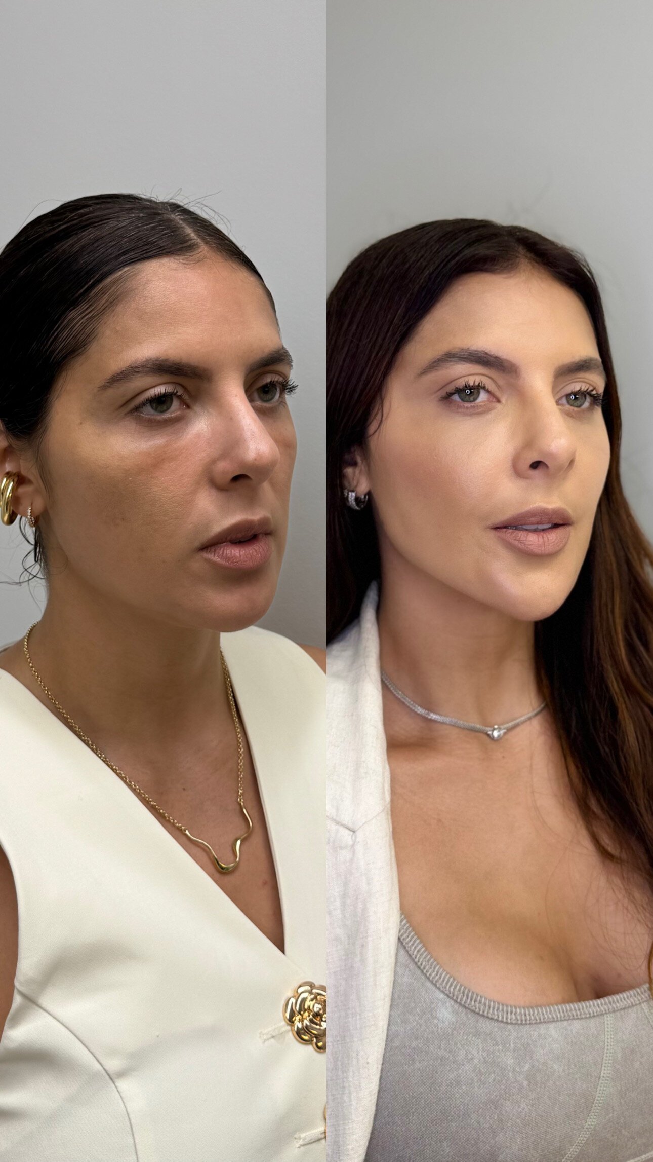 Resultado antes e depois do Instituto Welisson Carvalho