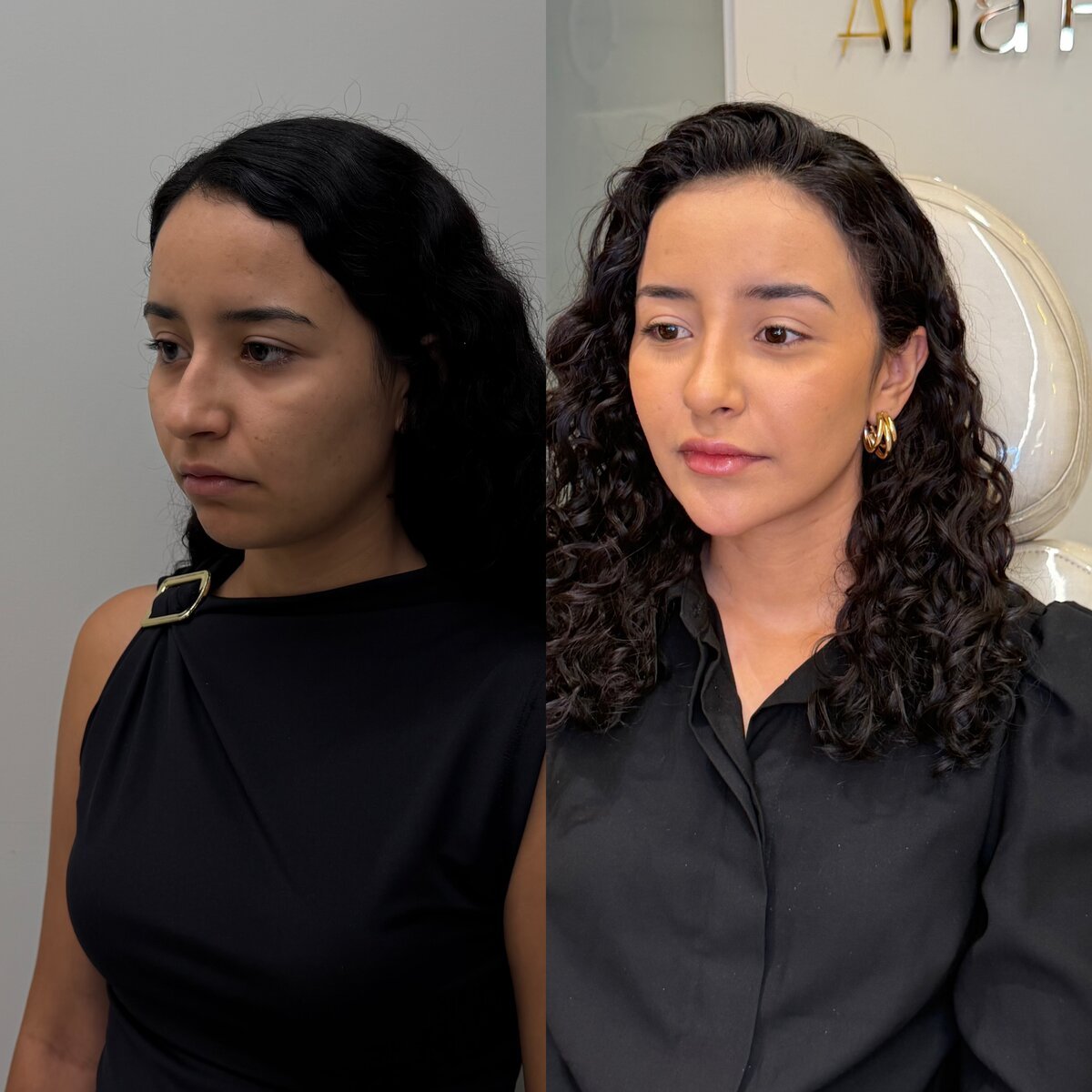 Resultado corporal antes e depois do Instituto Welisson Carvalho